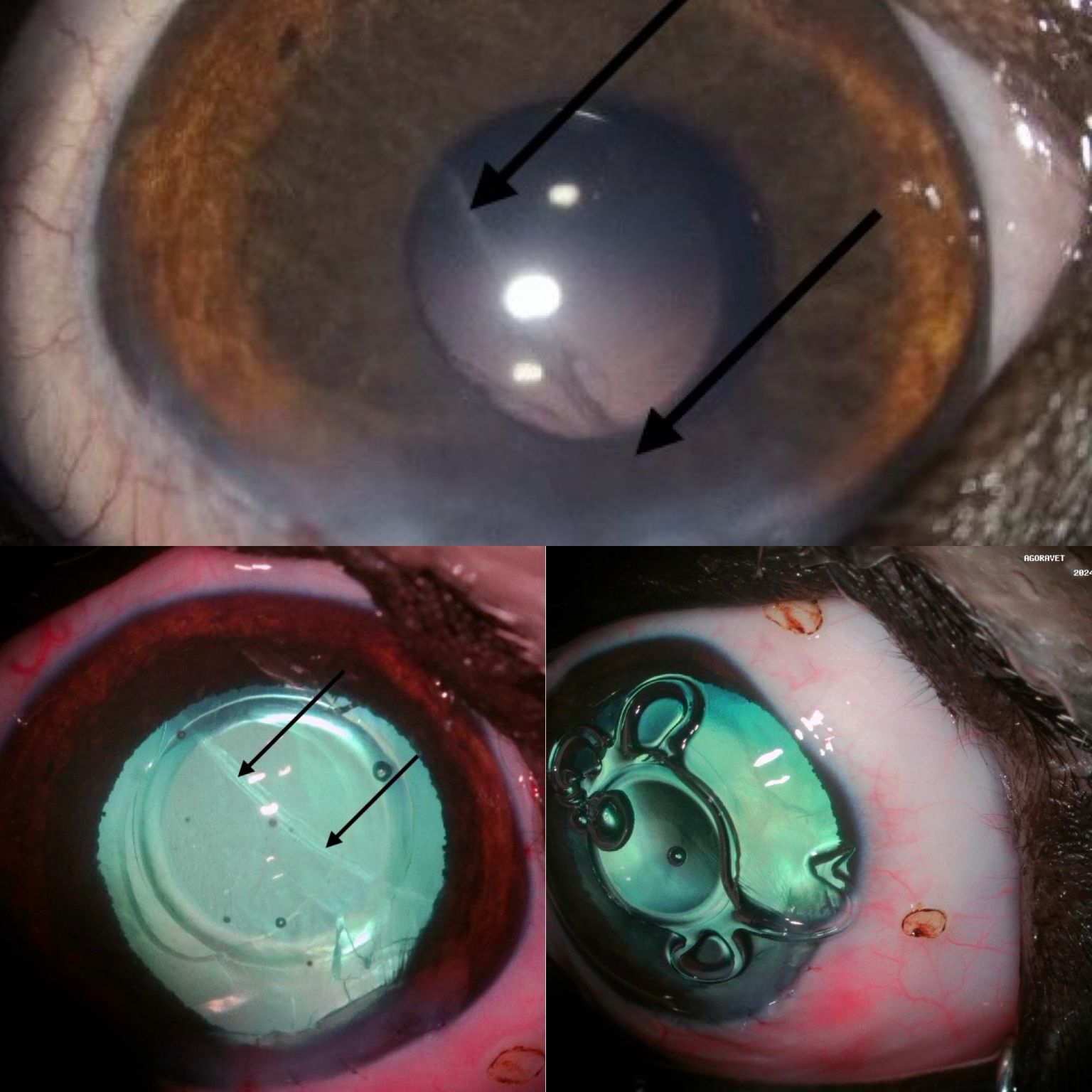 Images de chirurgie de l'œil avec annotations.
