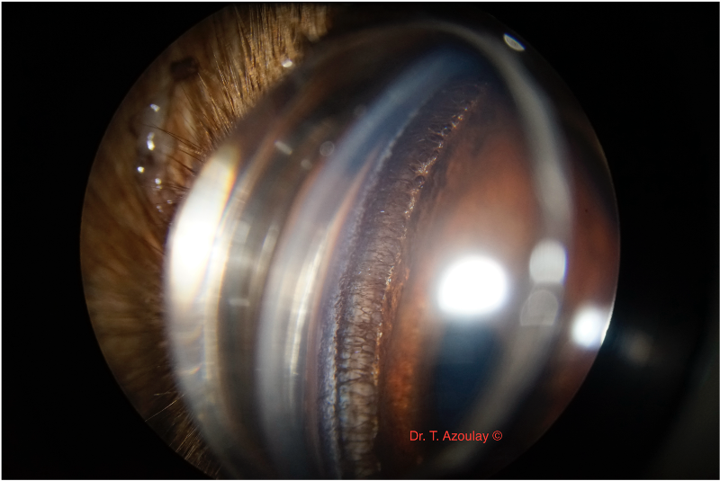 glaucome oeil chien